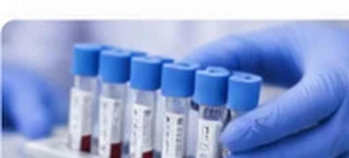 Laboratory specimen tubes